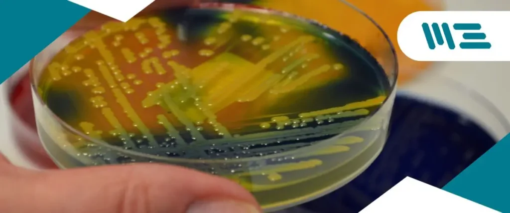 Eliminación y control de biofilms: claves para la seguridad alimentaria Implementa métodos efectivos para la eliminación de biofilms y asegura el cumplimiento de normativas alimentarias.