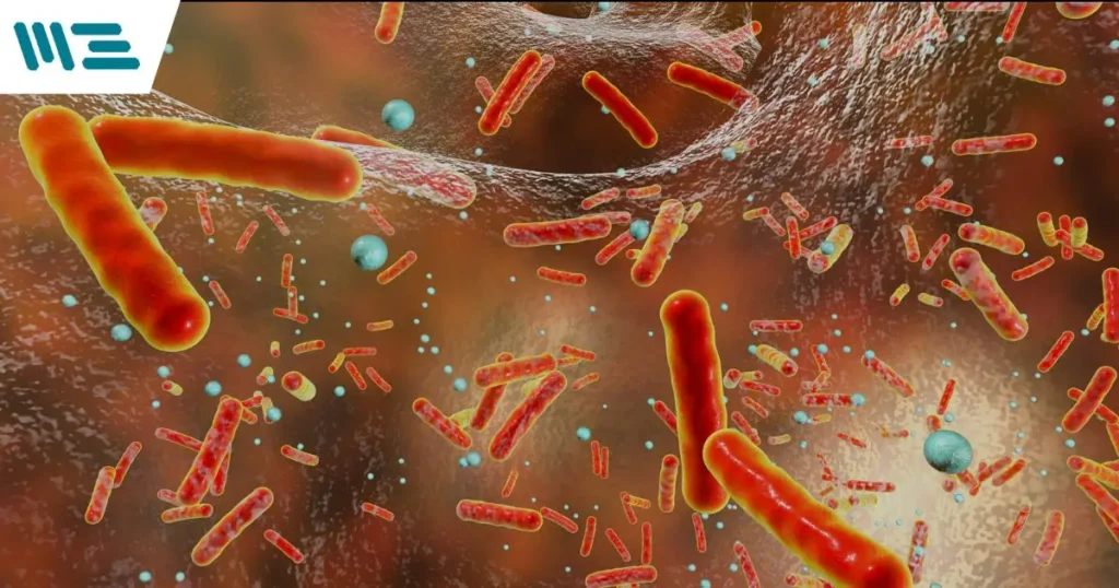 Implementa métodos efectivos para la eliminación de biofilms y asegura el cumplimiento de normativas alimentarias.